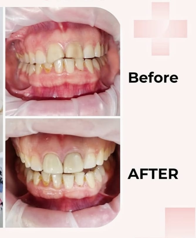 Dental treatment result