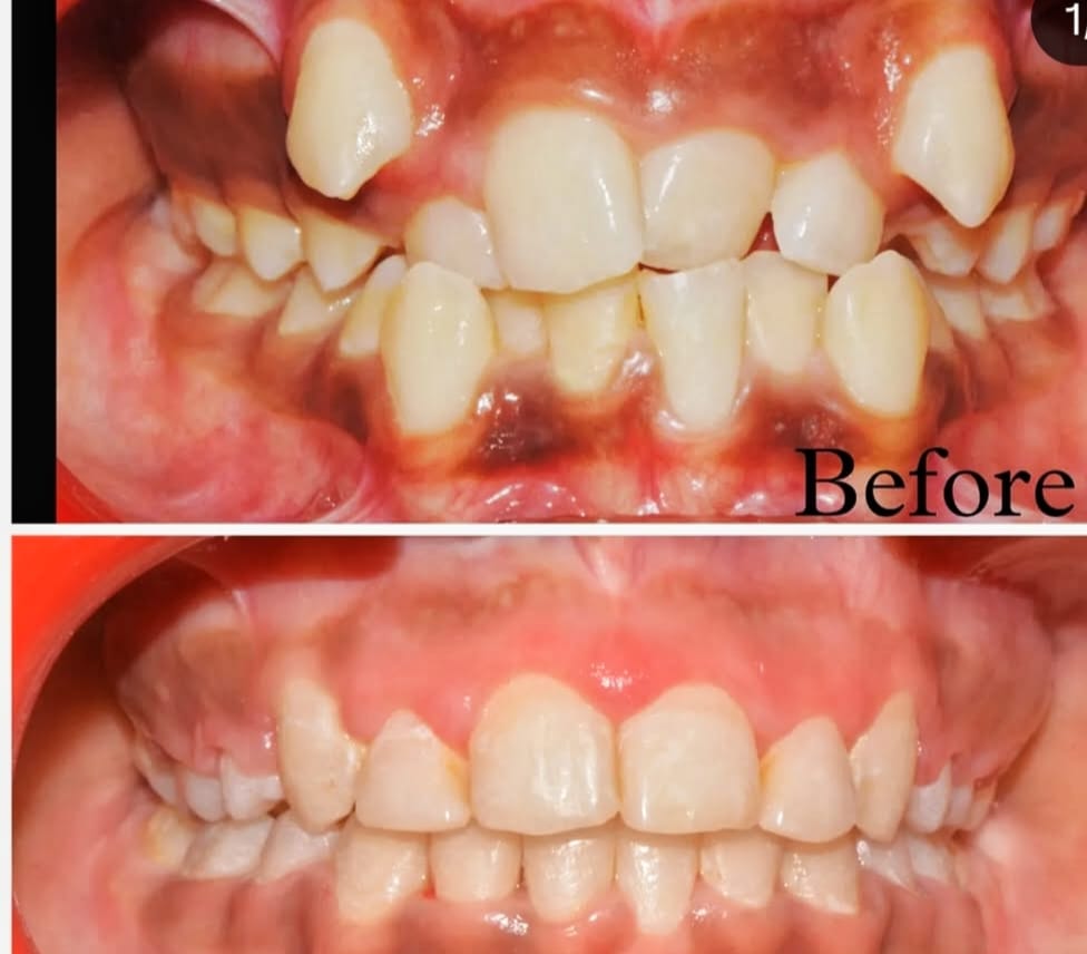 Advanced dental equipment