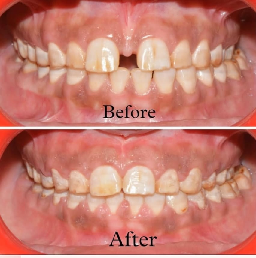 Patient success story